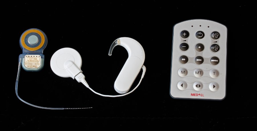 Cochlear Implant System